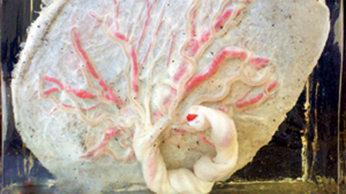 Nhau thai kh� b�n ở H� Nội.